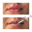 Enchimento Dermológico de Ácido Hialurónico Injetável Enchimentos de Melhora de Lábios