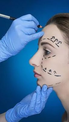 As rugas suaves e a linha da mandíbula definida com enchimentos faciais 70% HA cruzado ligado 24 mg 30% calcio hidroxilapatita