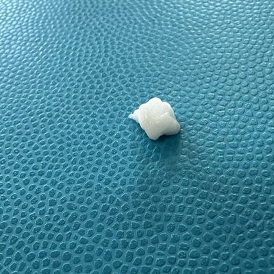 Gel de Ácido Hialurónico Injecção de Enchimento de Hidroxilapatita de Cálcio para Aumento do Chinho e Definição da Jawline