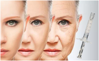 Ácido hialurónico antienvelhecimento do impulsionador 2ml Polycaprolactone da pele da face lift PCL