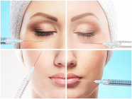 Enchimentos injetáveis ácidos hialurónicos do gel da injeção do sódio facial do enchimento do enrugamento para a cara