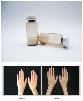 Preenchimentos Dermáticos Faciais Estéreis PLLA Ácido Hialurónico Gel Injetável Projetado para Correção Suave de Rugas e Restauração do Volume Facial