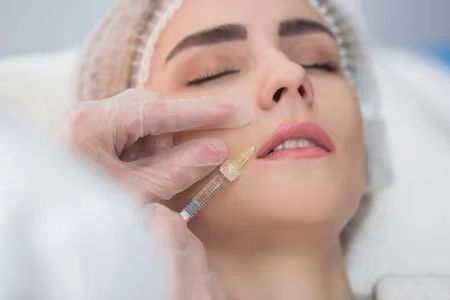 Embalagem da seringa Ácido hialurónico para rugas Enchimento nasal, Gel de injecção de ácido hialurónico