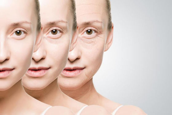 Ácido hialurónico Gel labial Injecções Rugas oculares Filler cutâneo sintético de ácido hialurónico