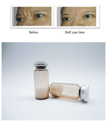 Biocompativel PLLA Injectable Filler Filler Dermal para restauração duradoura do volume facial e correção de rugas