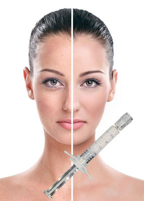 Cuidados com a pele cutâneos do enchimento da face lift PCL que levantam apertando o colagênio de estimulação