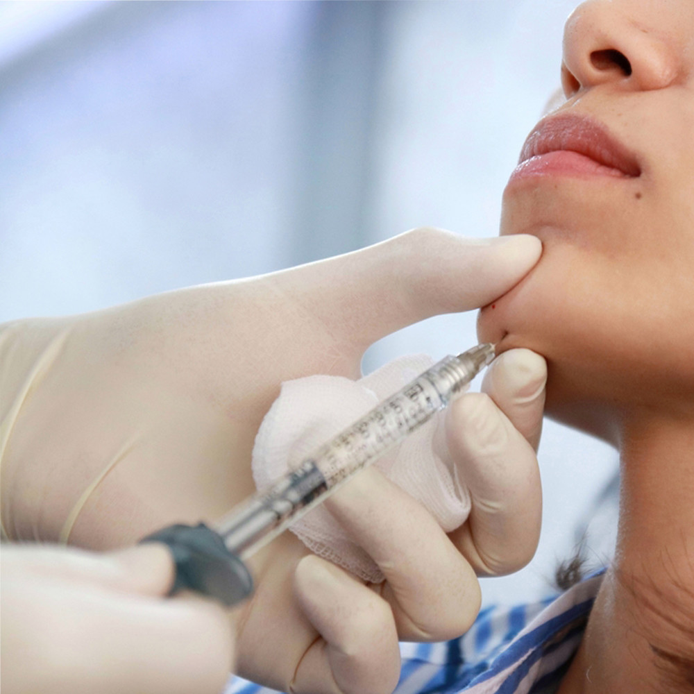 A cruz ácida hialurónica injetável médica do gel das injeções hialurónicas do gel ligou 24mg/Ml
